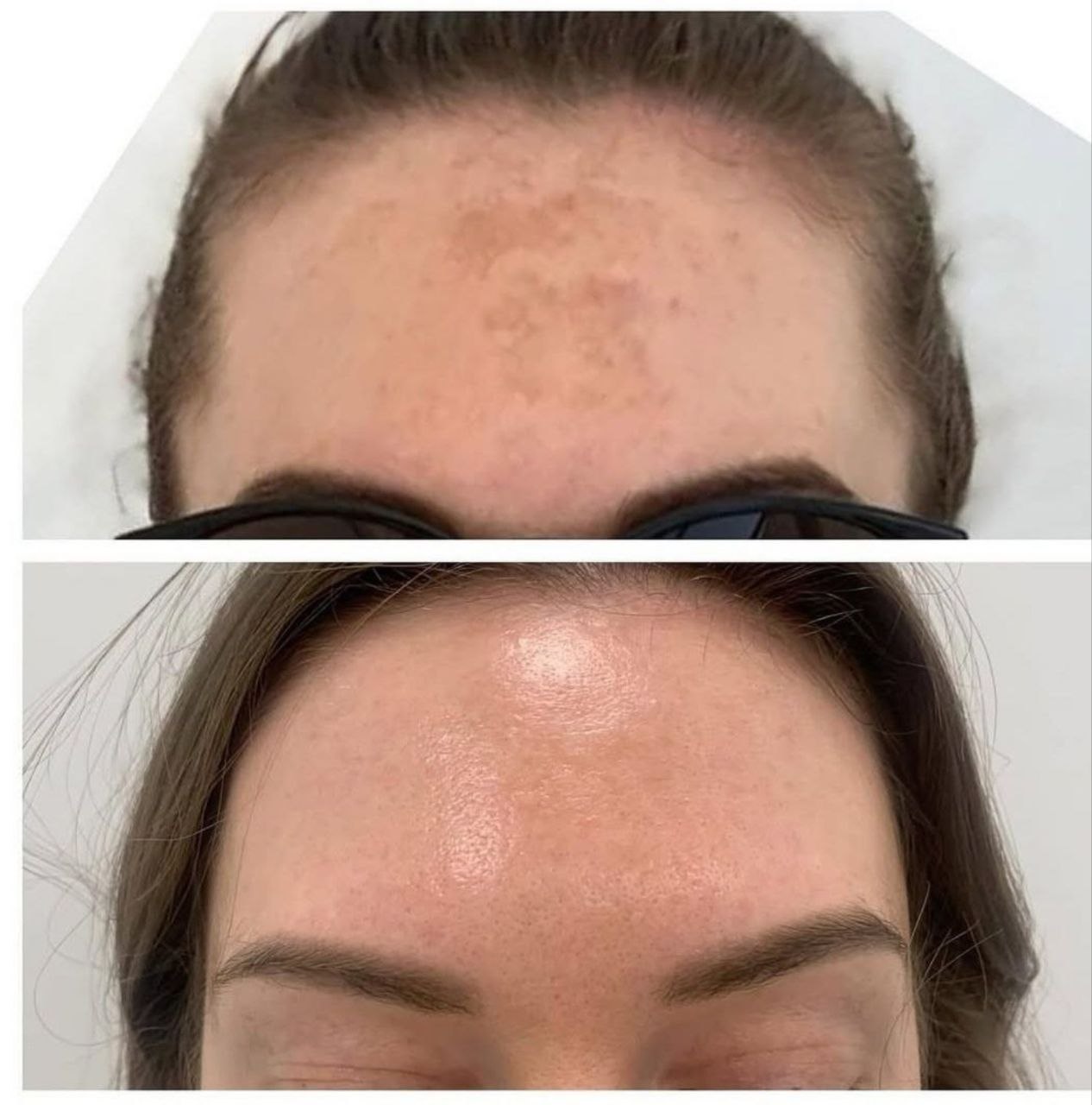 Пример практического применения авторского Skin Brightening — Фото № 6