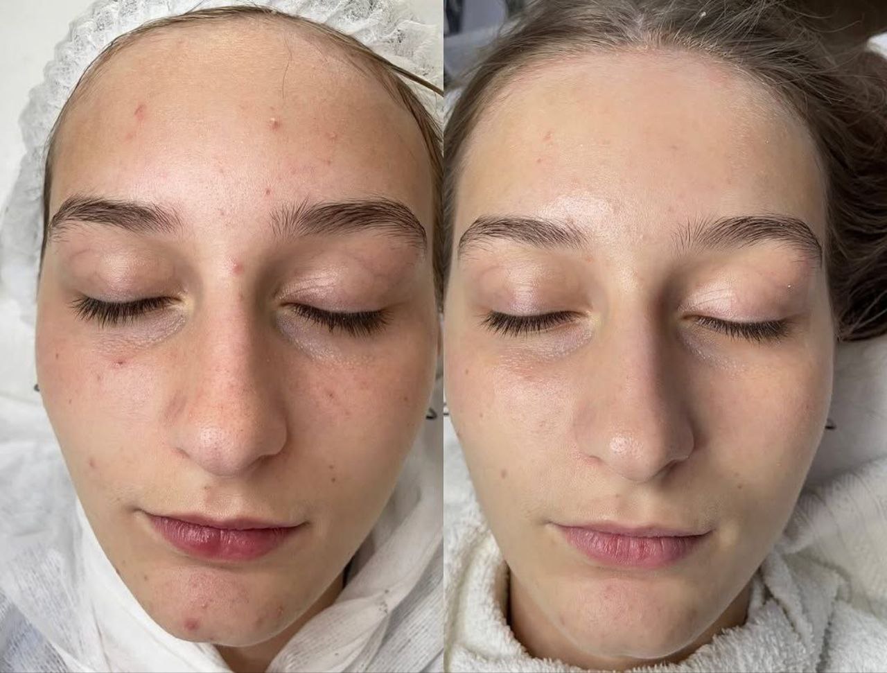 Пример практического применения авторского Skin Brightening — Фото № 8