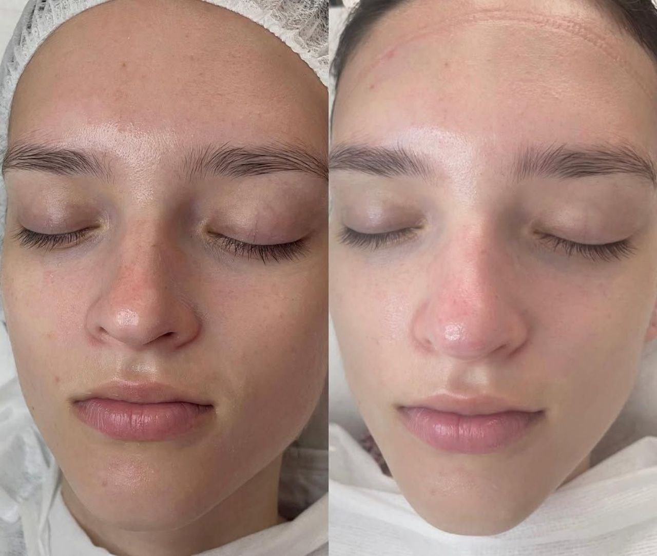 Пример практического применения авторского Skin Brightening — Фото № 9
